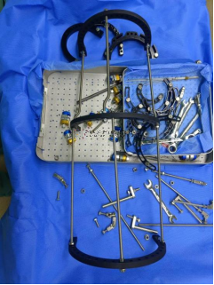 【最新病例】三臂十一軸機器人輔助器牽引——骨折外固定術骨折案例分享